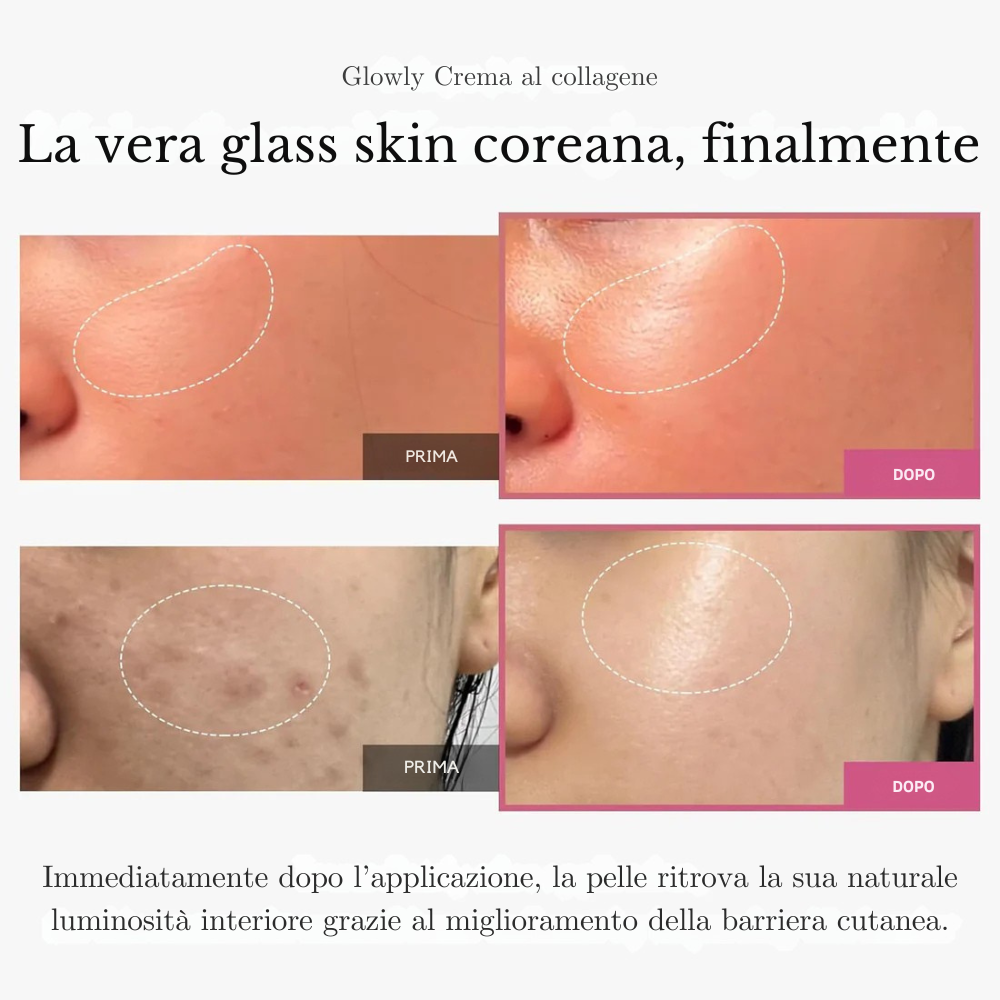 Glowly™ – leviga le rughe, affina i pori e dona nuova luminosità alla tua pelle